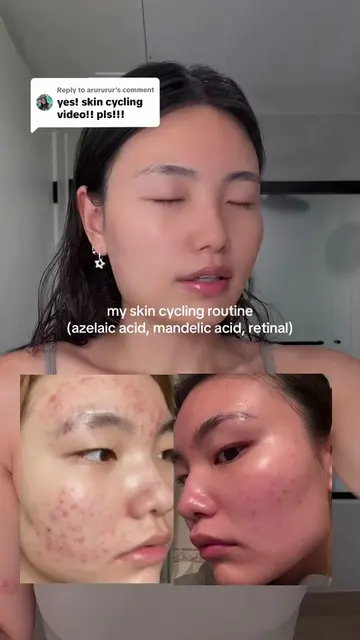 Replying to @arururur for oily dehydrated skin girlies! #skincycling #skincare #