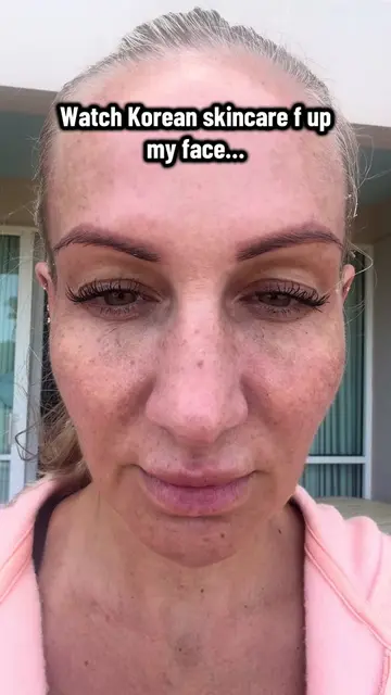 Pretty crazy stuff! #DrMelaxin #VolumeLoss #FineLinesAndWrinkles #Hyperpigmentat