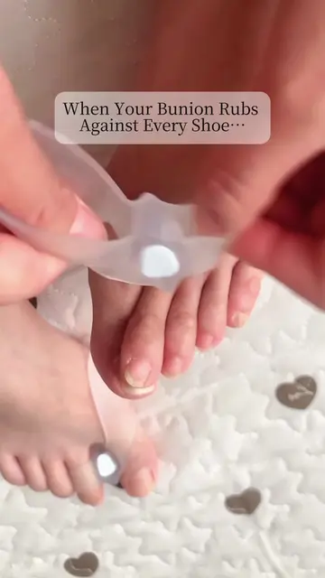 When a bunion starts rubbing against your shoes, the problem usually isn’t just 