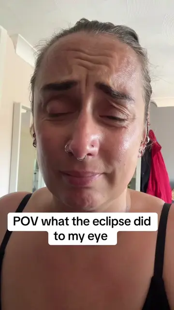 Did it happen to anyone else #eclipse #eyes #sun #pyp #viral 