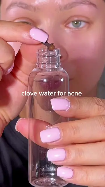 Clove water for acne 🤍 #skintok #skinhacks #clovewater #clearskin #acnetips 