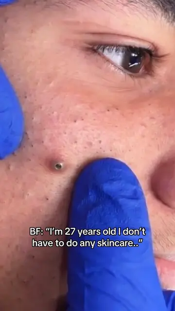 😳😳 #fyp #foryou #skincaretips 