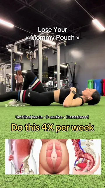 Most moms try to fix their post-baby belly the wrong way. If you’ve had a C-sect
