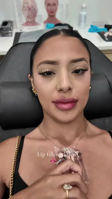 Asf 🥴 #lipfiller #relatable #fypシ゚viral #foryoupage 