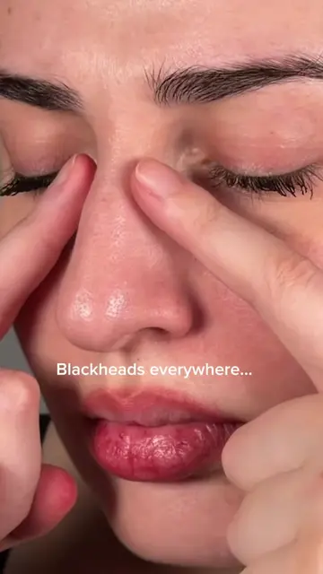 I didn’t know my pores needed this until I tried it 👀🍅 @FULLY Skincare  FULLY 