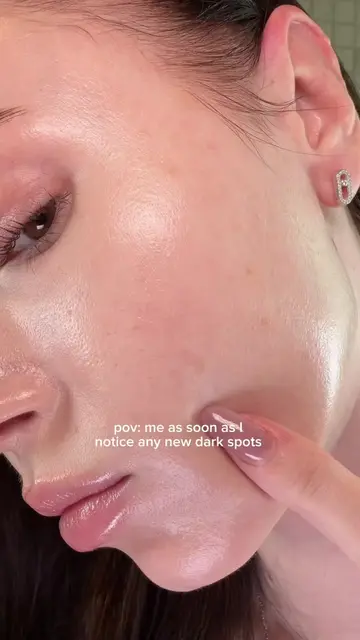 in dark spot cream we trust 🙂‍↕️ AD #celimax #darkspots #hyperpigmentation 