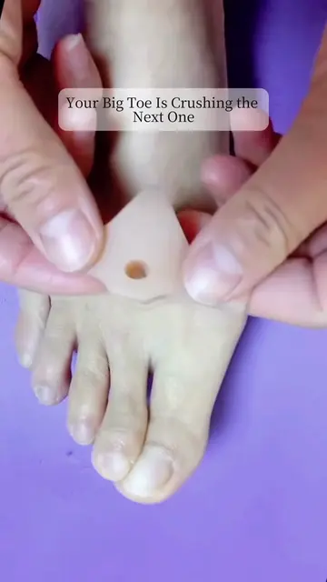 When the big toe keeps pushing into the second toe, the pressure doesn’t stop wh