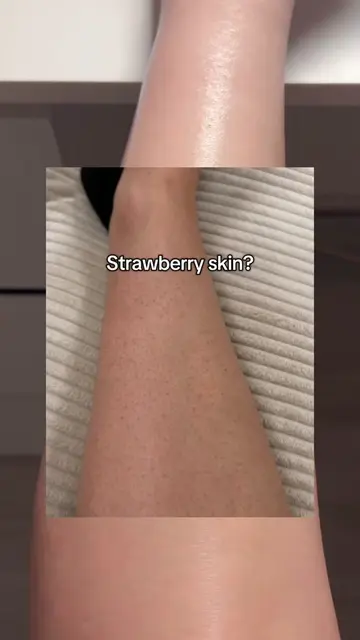 multifunctional 🤪 #chickenskin #hyperpigmentation #retinal #koreanskincare #num