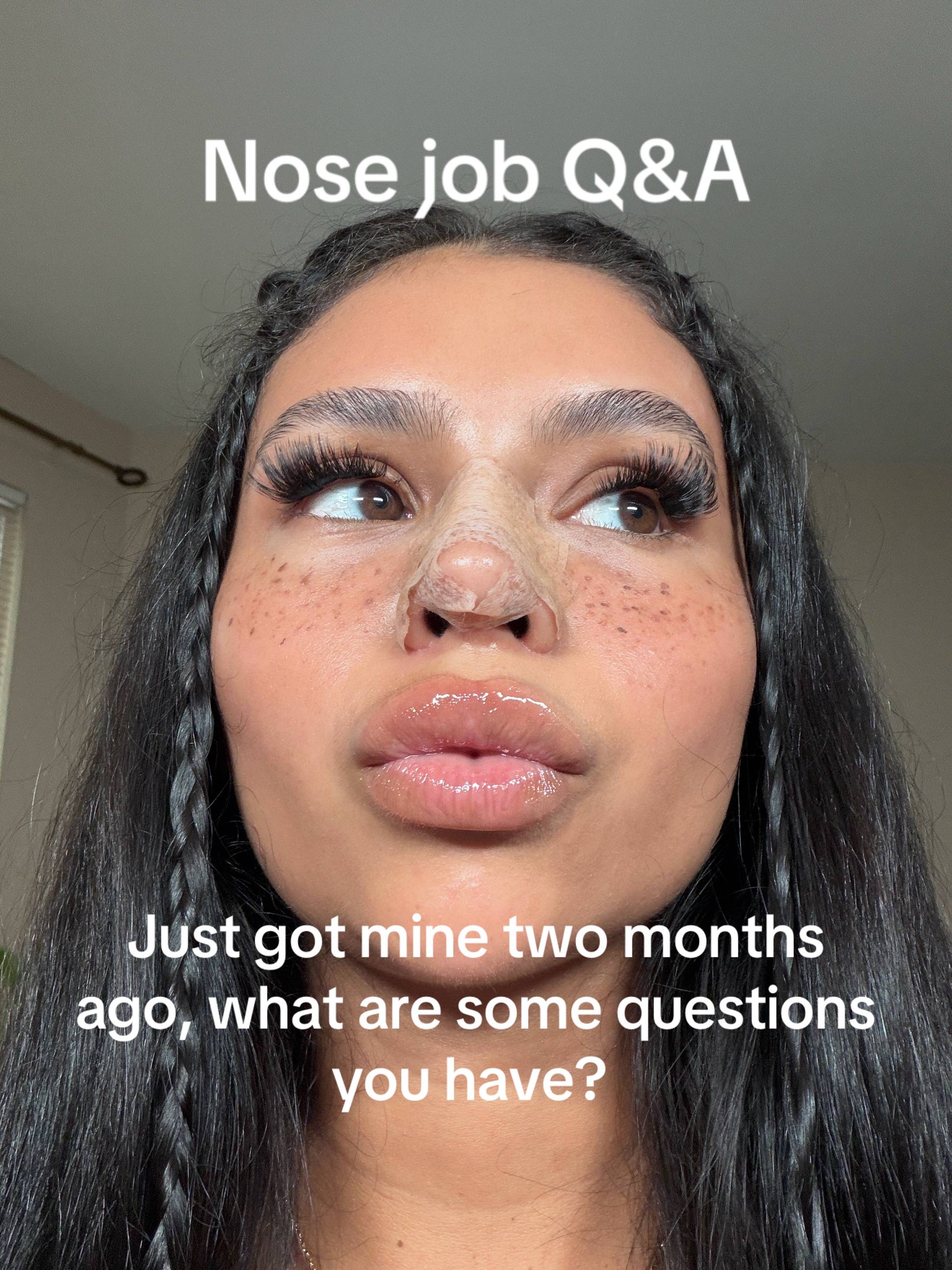 Answering all your nose job questions 😇 #nosejob #nosejobcheck #nosejobturkey #