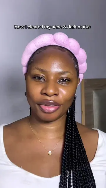 How I cleared my acne & dark spots using the @purito_official PURITO Seoul Azela