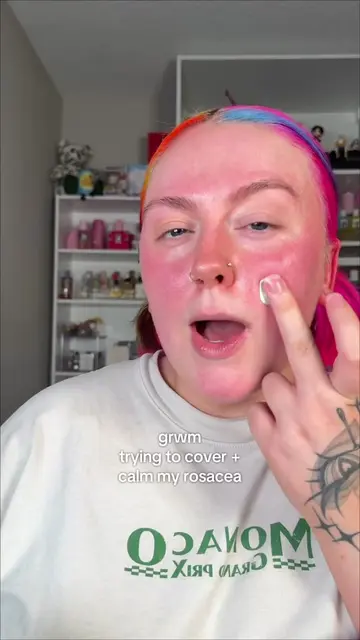 Rosacea flare up AND being in a rush🫩💔my worst nightmare fr #erborianpartner  