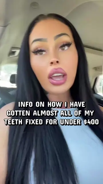 How I was all of the teeth I needed repaired & have only paid $371 out of pocket