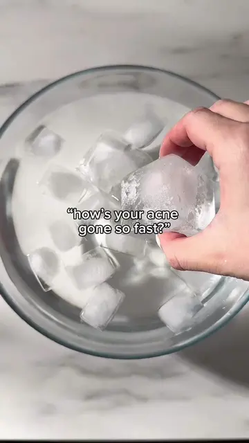 Acne hack for fast healed skin 🤍  #acneprone #breakout #pimples #inflammation #