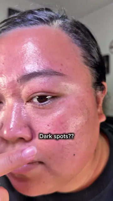 Dark spots? We’re working on it 👀✨ @PURITO SEOUL  #puritoseoul #puritotop100 #s