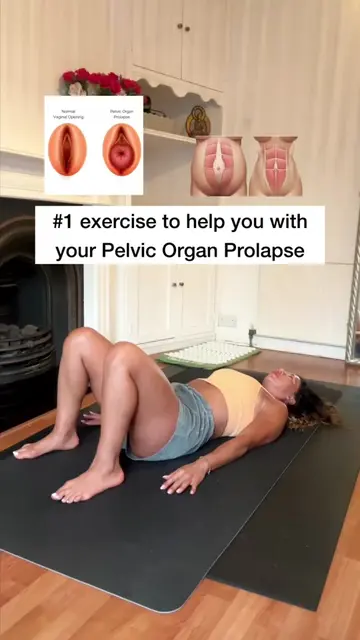Ladies, if you’re dealing with pelvic organ prolapse, you’re NOT alone. 🫂🤍 Her