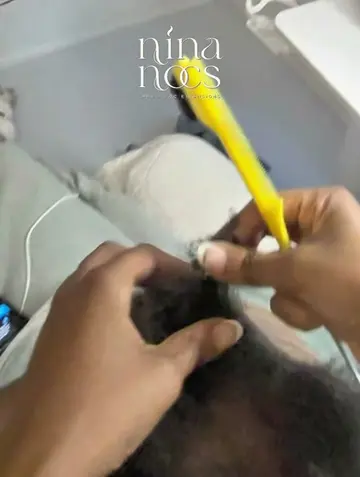 Here is her BEFORE. She has low-density hair with visible scalp, sparse thinning