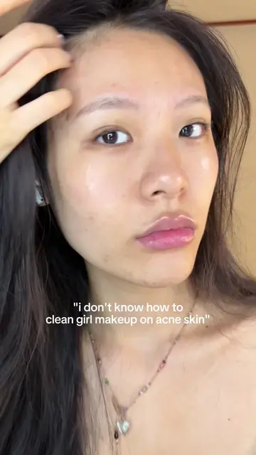 Tutorial uploading tomorrow! Follow for more acne skin tips <333  #koreanskincar