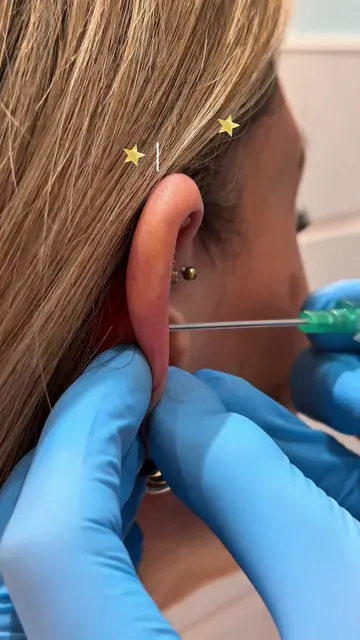 Have you got this piercing?! Rate your outerconch piercing pain in the comments!