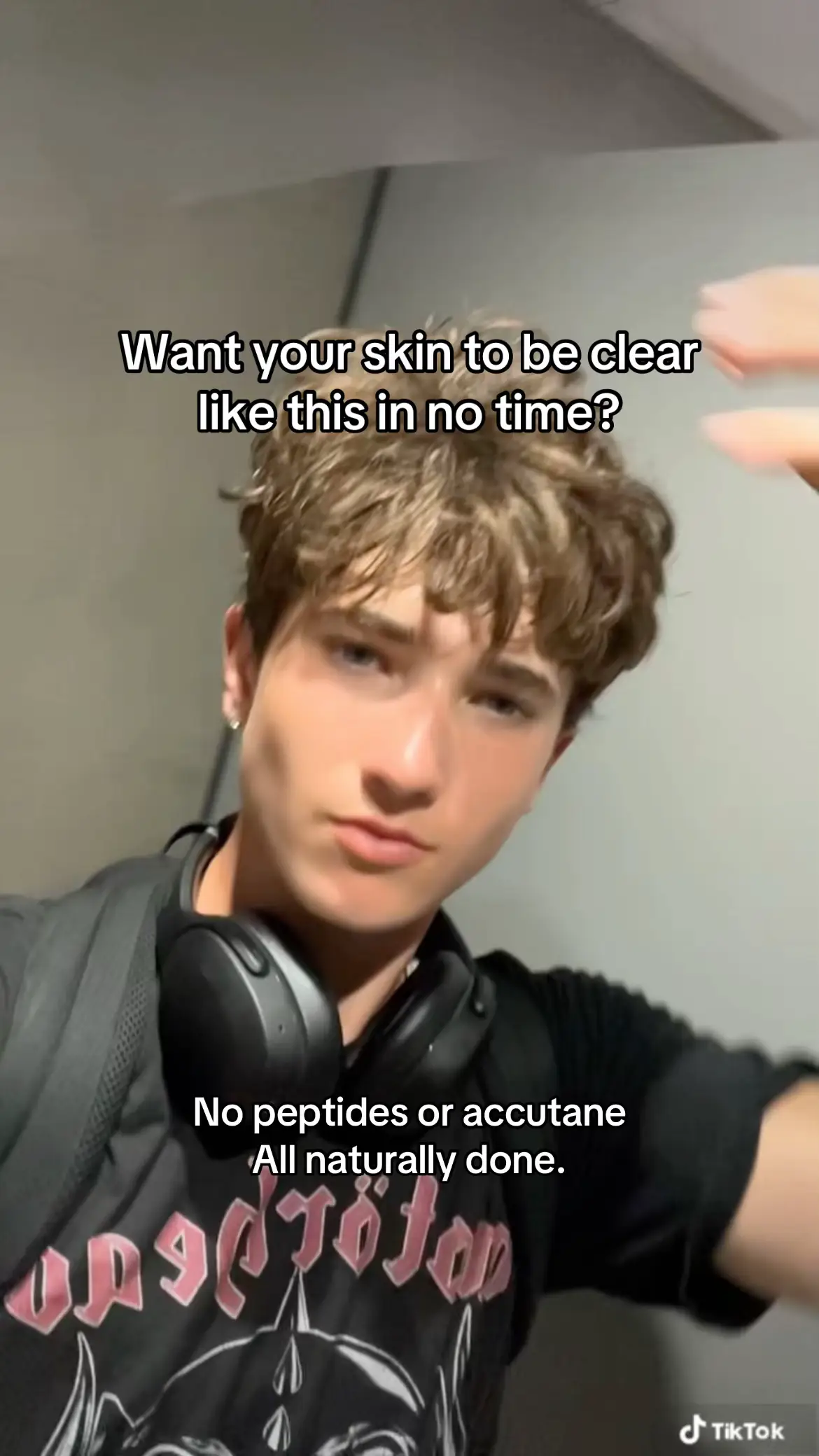 #skincaretips #acnetips #glowuptips #creatorsearchinsights #viral 
