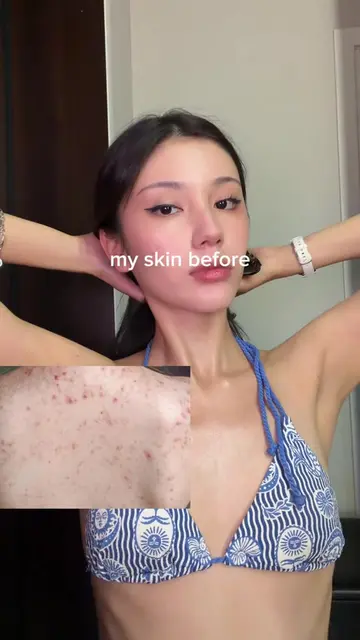my every day body care🤎 #knock #bodyacne #knockbodycare #knockbodyscrub #glycol