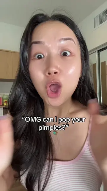 POV: taking skincare advice from someone who never had acne before 🥹 #acne #ski