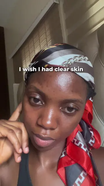 Korean skincare helped with my dark spot but only when I learnt how to properly 