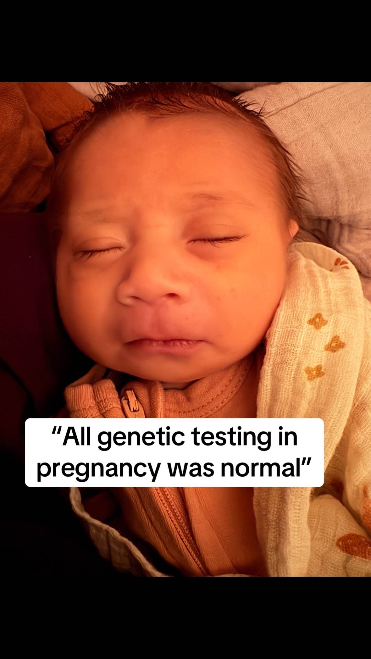 There’s only about 100 cases of HUWE1-related neurodevelopmental disorder record