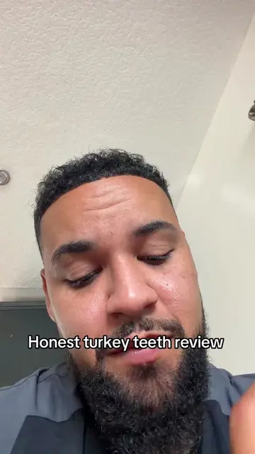 Honest turkey teeth review 1.5 years in  #turkeyteeth #review #veneers 