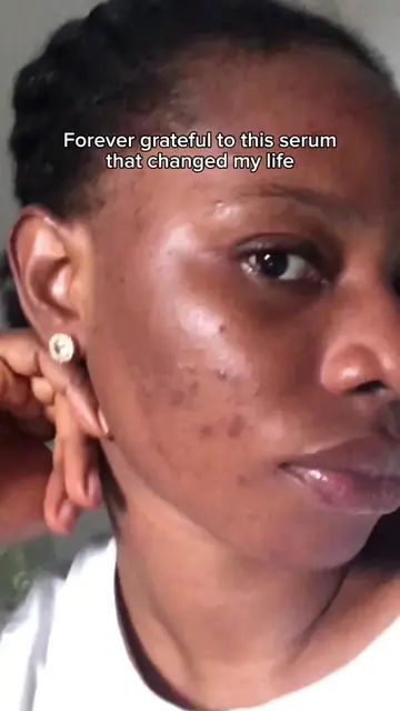 Proof that consistency is everything. This serum officially has a permanent spot