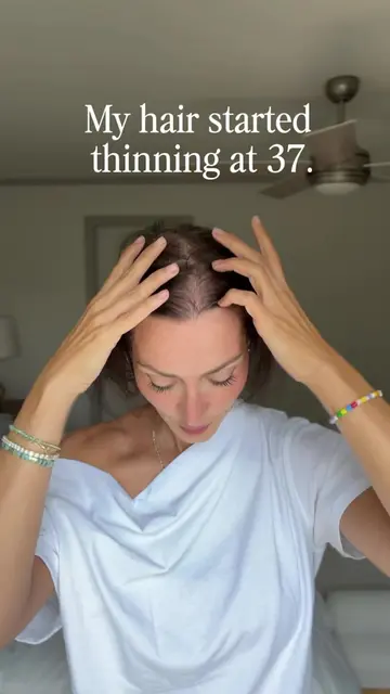 I began losing my hair at 37. It shocked me. I was unprepared. I had never heard
