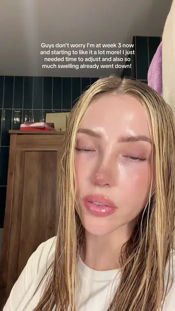 The crash out video is from week 2!! Also makeup filter to get a better idea of 