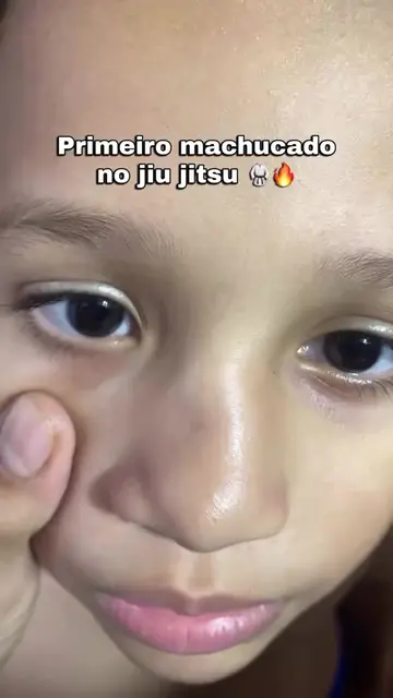 Já machucaram no jiu ?  #MamaeBJJ #JiuJitsu #JiuJitsuInfantil #ProjetoSocial 