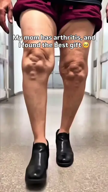 If you suffer from arthritis or knee pain, this will help you...❤️ #kneearthriti