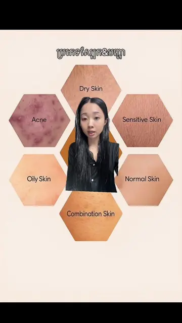មេីលប្រភេទស្បែកសិនណា✏️#fypシ゚viral 