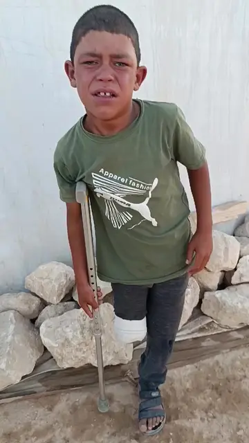 #humanitarian  #heartbreaking  #survivor  #kids  #globalimpact 