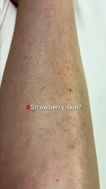 Strawberry skin? This is how I got that smoother-looking glow. 🍓✨ @numbuzin  #c