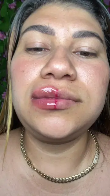 😂me veo como si las abejas me besaron😂😂😂😂 #laka #LipPlumper #MaquillajeVira