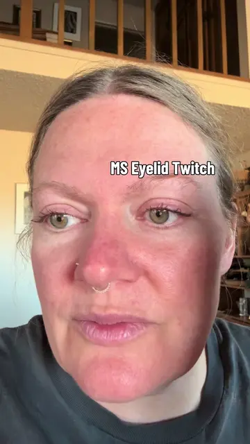 MS Eyelids Talking to Me!  As a kid, twitches were kind of fun. “Look! My eye is