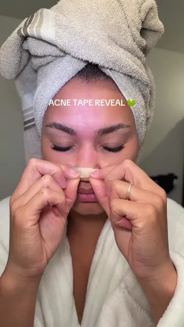 Stop wasting money on over priced pimple patches !!! #acne #acnetreatment #pimpl
