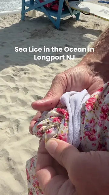 Prepare to be itchy if you’re in the ocean 😬😬😬 everyone on the beach said the