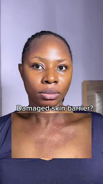 One simple step for soft, glowing skin everywhere. #axisy #skinbarrierrepair #bo