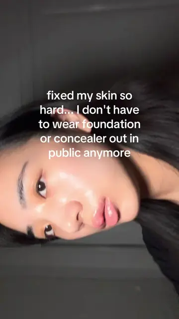 #acne #acnetreatment #skincare #tretinoin #azelaicacid 
