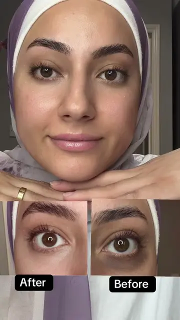 Stop using retinal alone is not enough ❤️@numbuzin ❤️ #darkcircles #under_eye #r