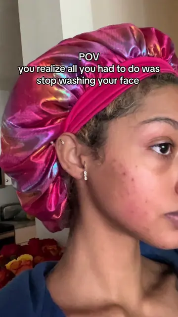 but let’s really talk about it tho…  #skincare #acne #journey #clearskin 