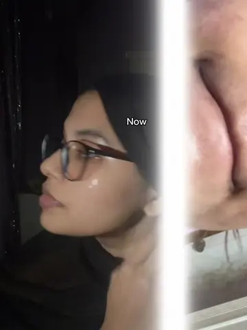 Mashallah 🥹 #foryourpage #support #grow #viral #skincare 