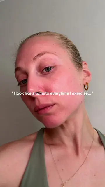 ad The before and after is WILD!!! 🫢 Why is no one talking about how good this 