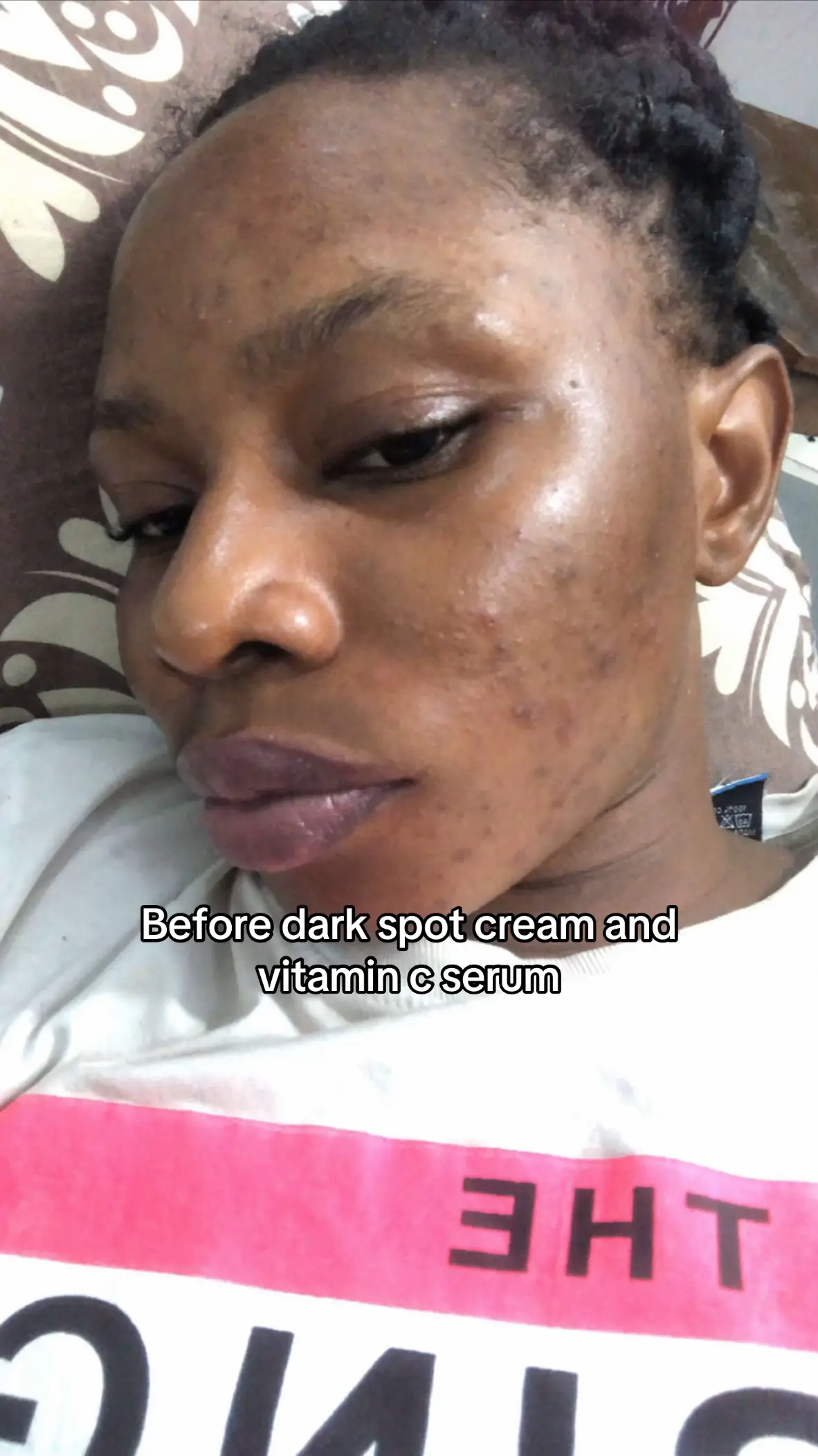 Fading dark spots takes time, but pairing the Dr. Althea Melaclear Cream with th