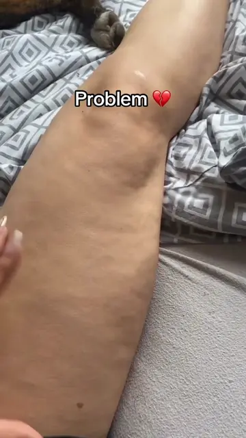 From “I need to do something about this” to finally having a routine that fits i