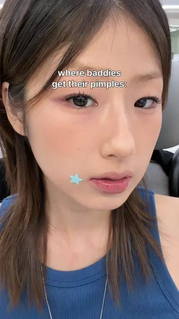 Baddies even get cute pimples… but me? Tell me I’m not the only one. Drop a comm