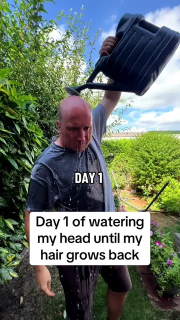 Day 1 of watering my head until my hair grows back 